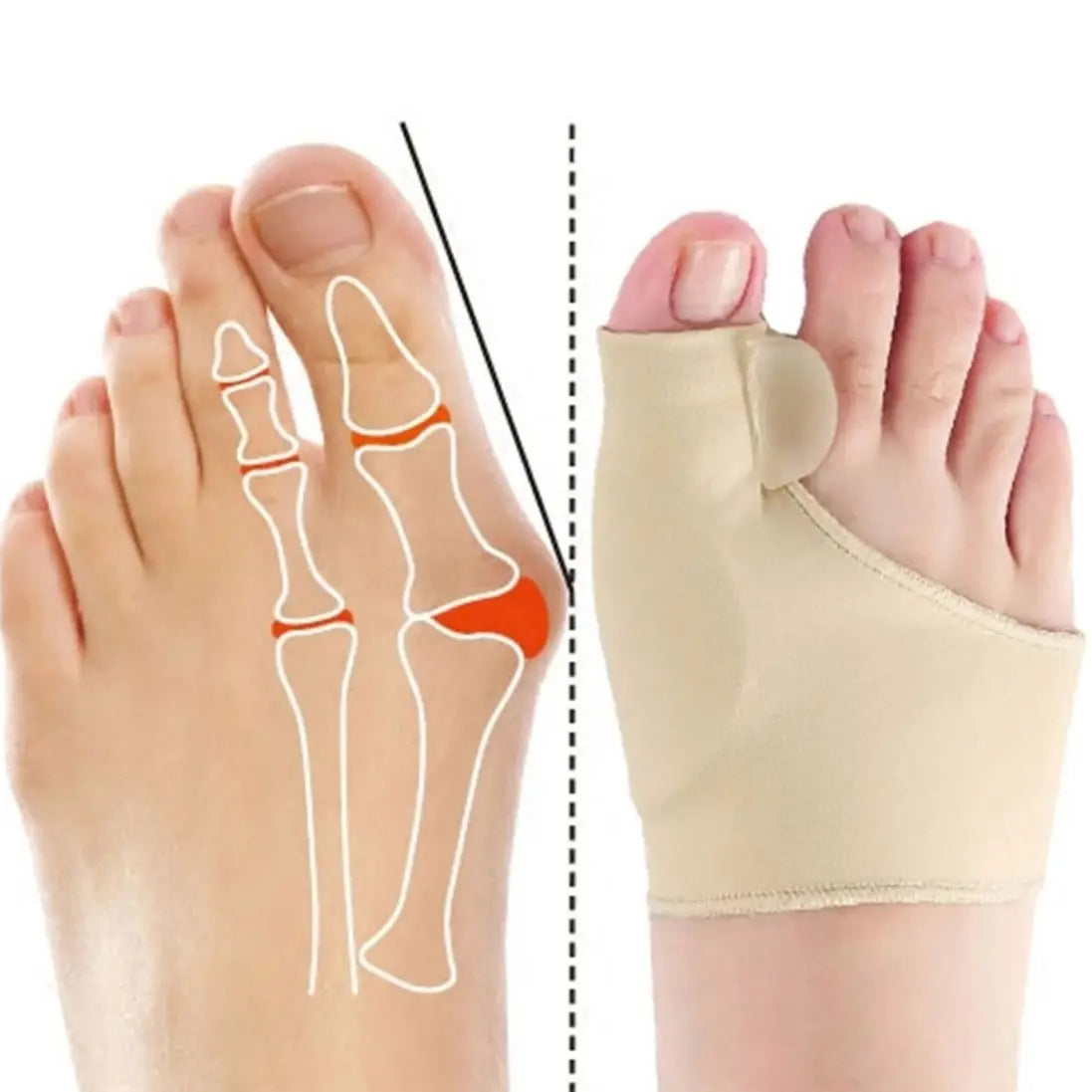 Orthopedic Toe Straightener with a Massage Ball