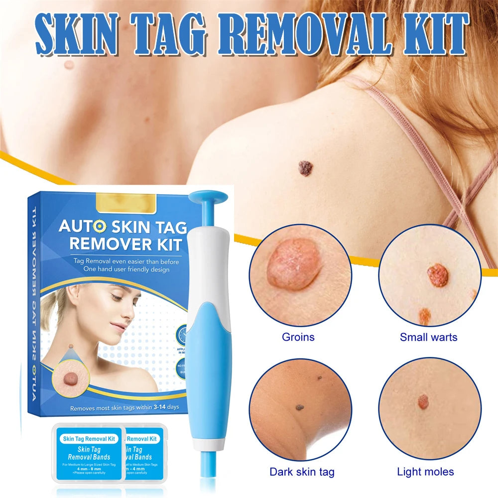 Painless Skin Tag Remover