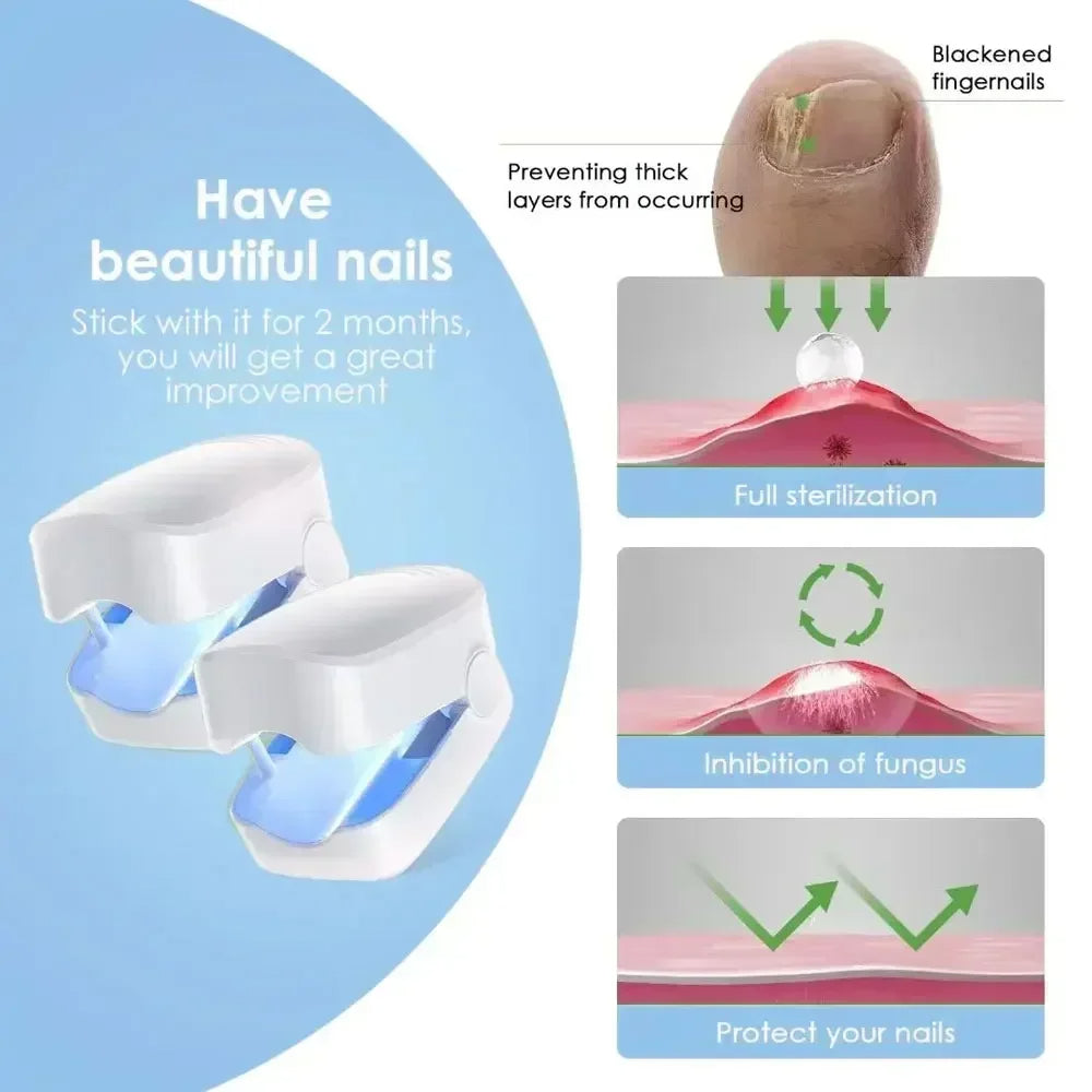 Nail Fungus Cleaning Laser Device - Expert Revolutionary High-Efficiency Light Therapy Device For Toenail Diseases