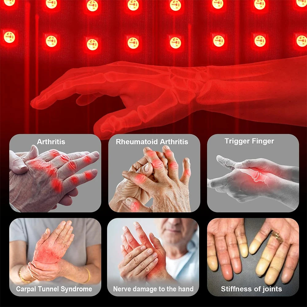 Red Light Therapy Gloves – Targeted Joint Pain Relief for Hands