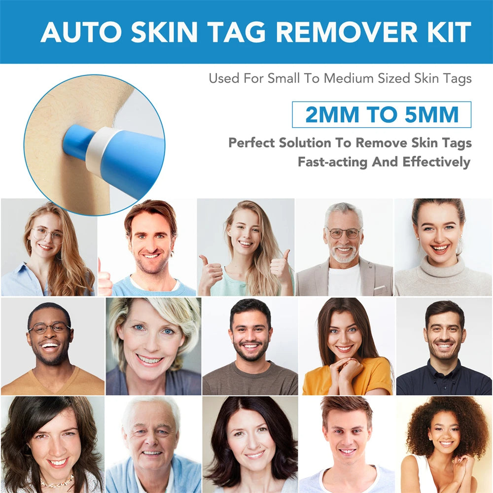 Painless Skin Tag Remover