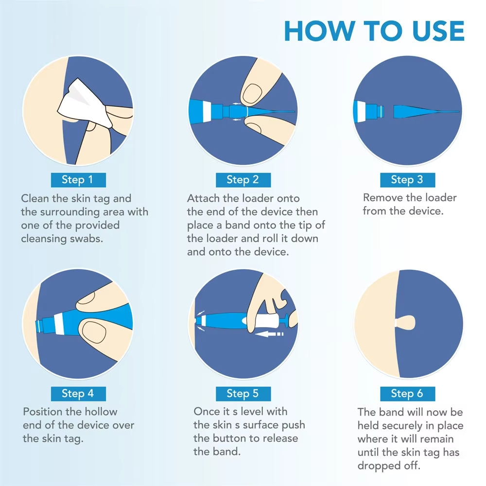 Painless Skin Tag Remover