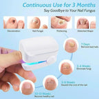 Nail Fungus Cleaning Laser Device - Expert Revolutionary High-Efficiency Light Therapy Device For Toenail Diseases