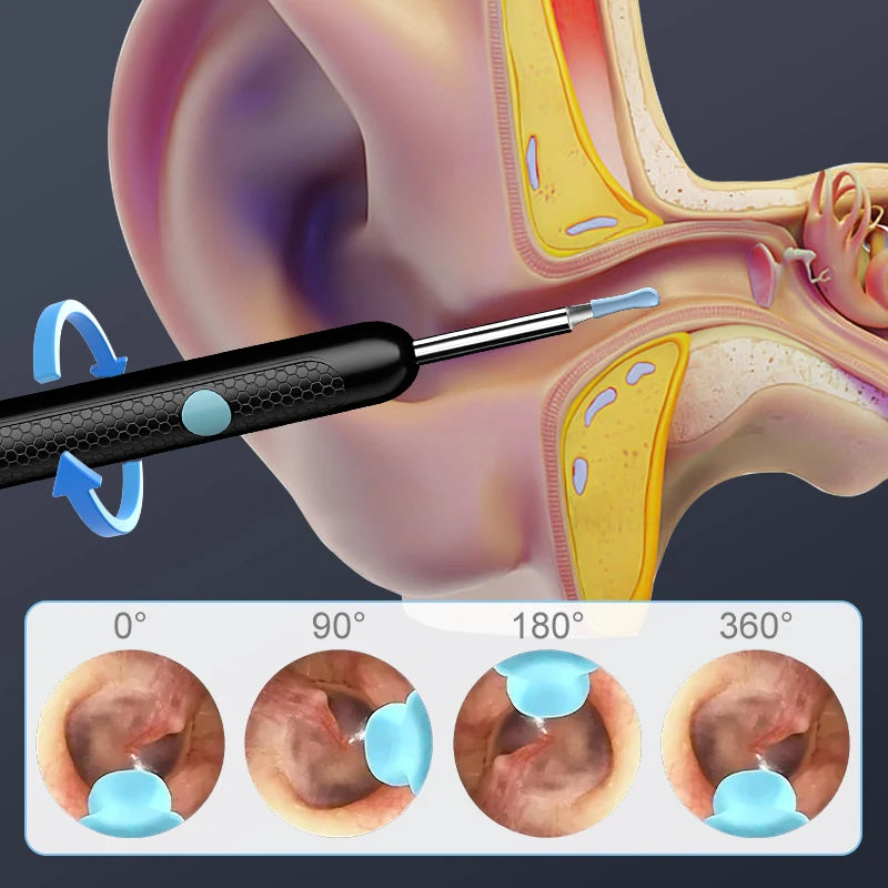 Ear Wax Removal
