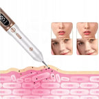 Stylo Plasma pour enlever les grains de beauté, les verrues et les taches cutanées